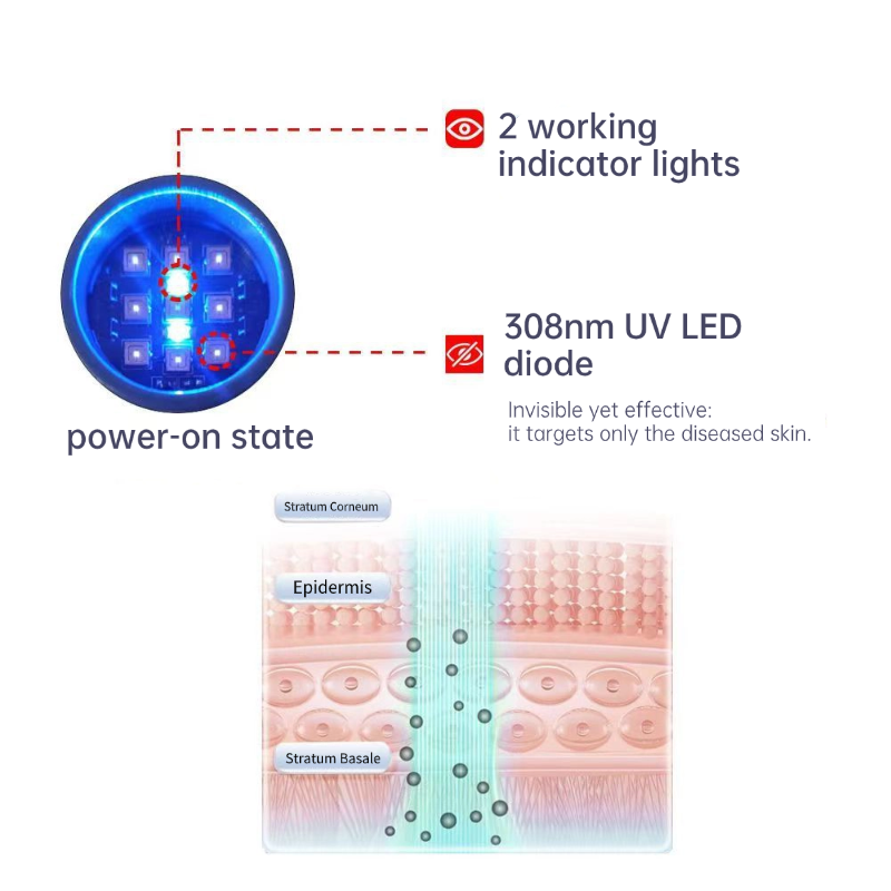 Hand-held UV Phototherapy Device